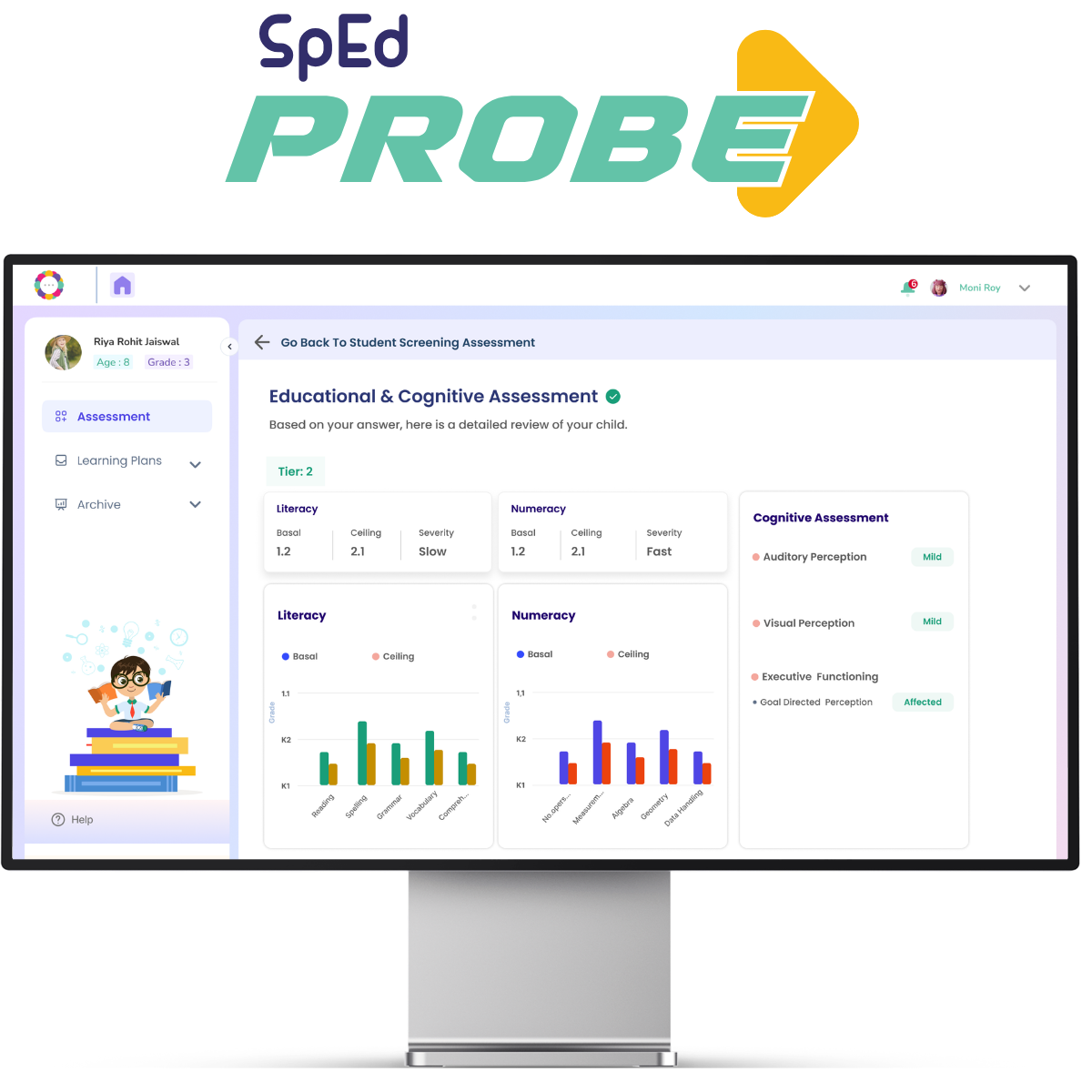 SpEdProbe Banner